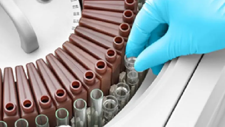 Analyseur de chimie clinique automatique BS-360E – Image 2